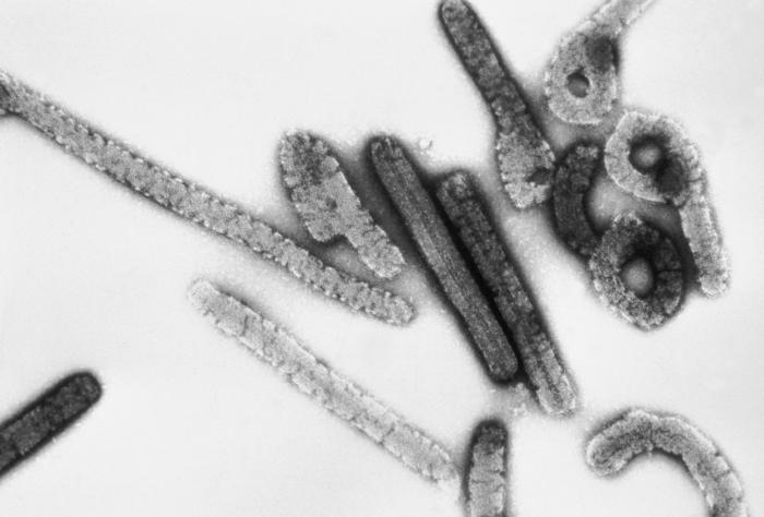 Afrika'nın üst düzey sağlık yetkilisi ABD'den Uganda'ya Ebola seyahat yasağını kaldırmasını istedi