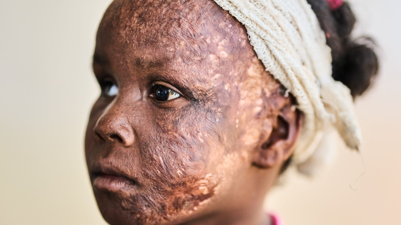 Amnesty: Sudanlı RSF etnik temizlik yaptı