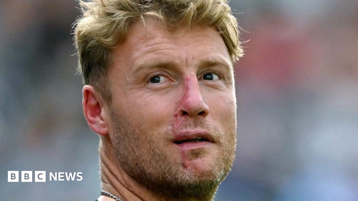 Flintoff'un Top Gear Kazasında Yaralanan Sürücü BBC'ye Dava Açtı