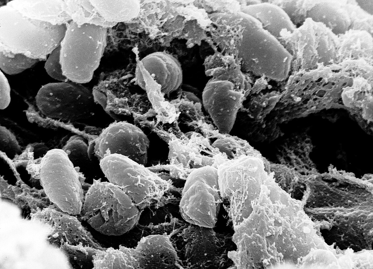 Antik DNA, veba tarihini yeniden yazıyor