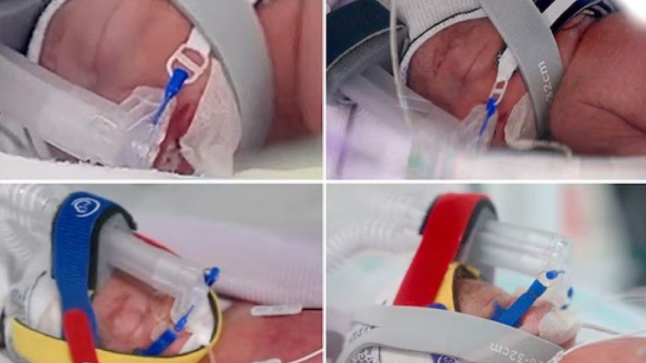Avustralya'da 3 Milyarda Bir Şans: Aynı Anda 4 Kız Bebek Doğdu