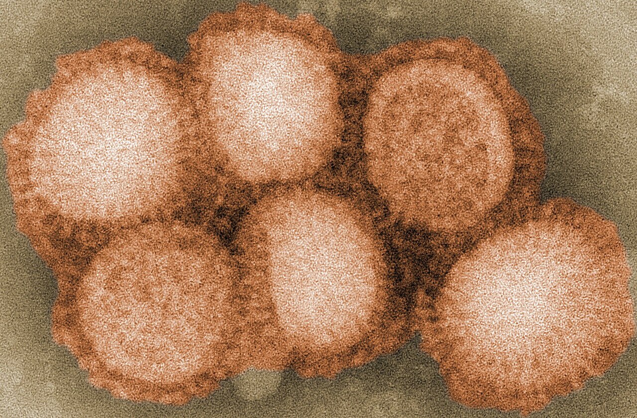 Avustralya'dan H5N1 uyarısı: İlk toplu ölümden sonra yayılabilir