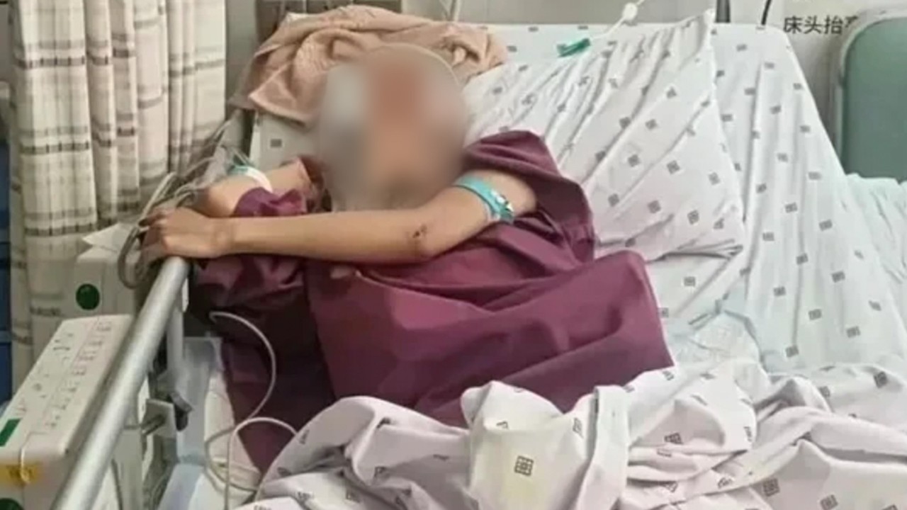 Çin'de 20 yaşındaki kadın, erkek arkadaşıyla tartıştıktan sonra 18. kattan atlayarak mucizevi şekilde kurtuldu
