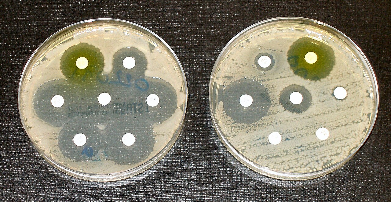 Dünya çapında antibiyotik direnci çocukları tehdit ediyor