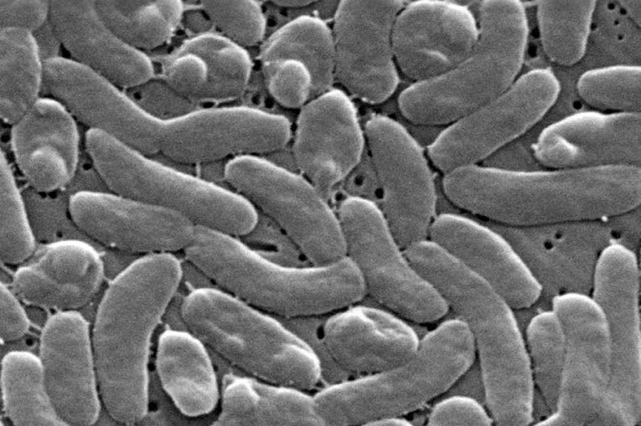 Et yiyen bakteri ölü sayısı artıyor: Vibrio belirtilerine dikkat