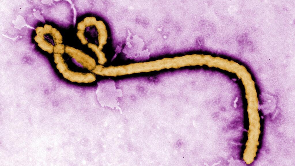 Fransa'da ilk Ebola vakası: Kongo'dan dönen doktarda tespit edildi