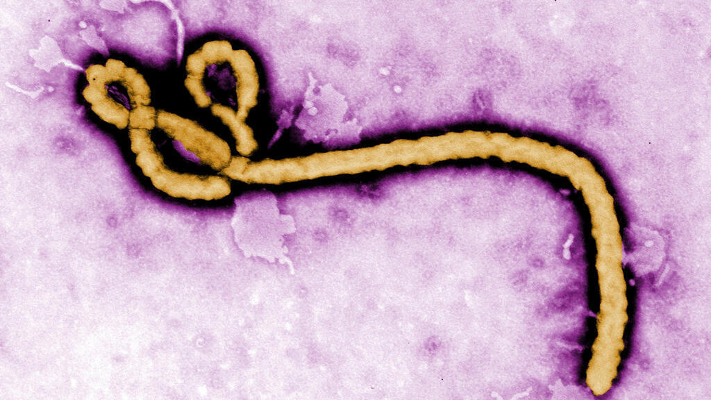 Fransa'da ilk kez tespit edilen Ebola hastası iyileşti ve taburcu oldu