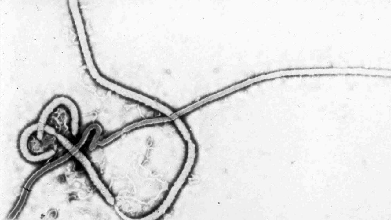 Fransa'da Ebola: Dr Kongo Dönüşü İlk Vaka Doğrulandı