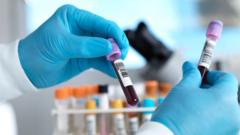 İngiltere Hepatit C'yi yok etmeye hazırlanıyor