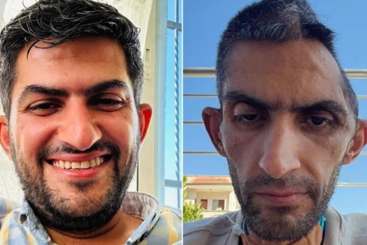 İsrail hapishanelerinde 'vahşet': Serbest bırakılan Filistinli gazetecinin fotoğrafı şoke etti
