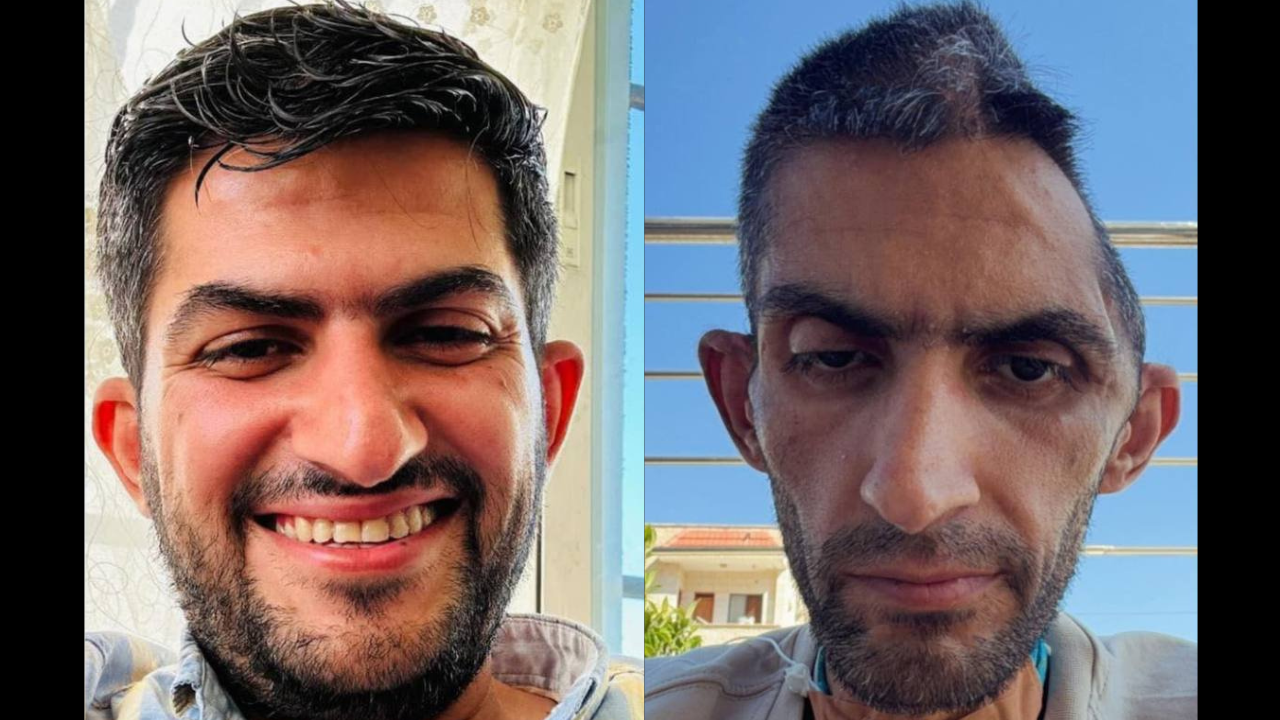 İsrail'den serbest bırakılan Filistinli gazetecinin fotoğrafları infial yarattı