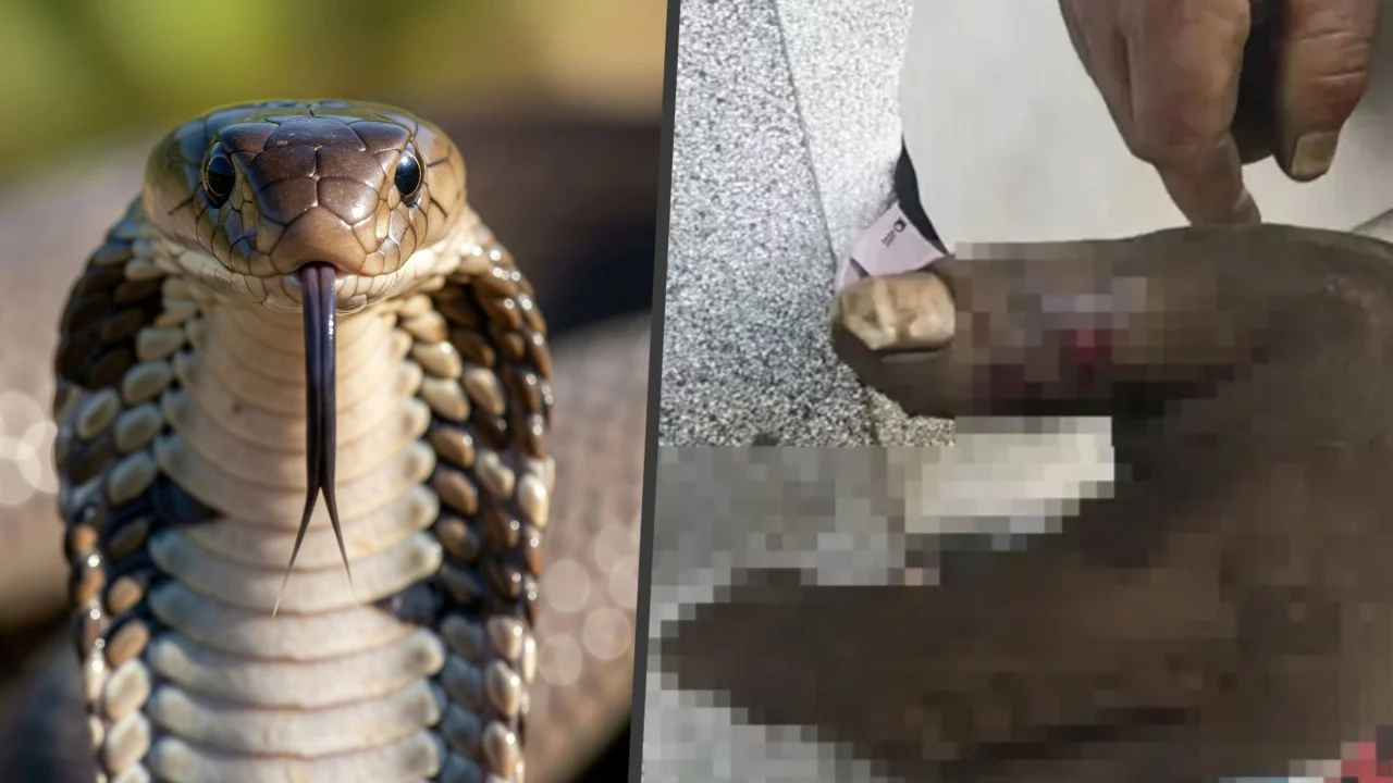 Kobra Zehrini Emen Kadın Kendini Zehirledi