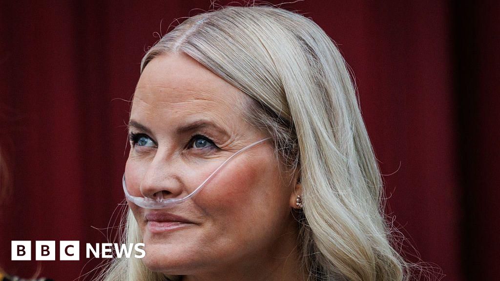 Norveç Veliaht Prensesi Mette-Marit'e Akciğer Nakli: Saraydan Açıklama
