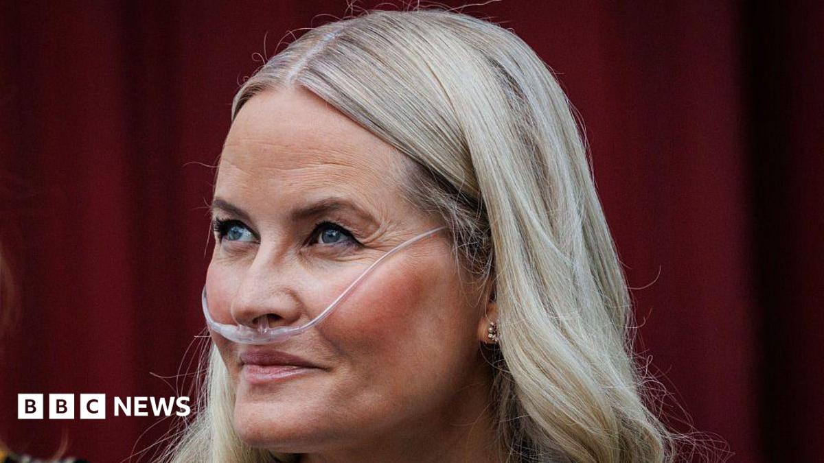 Norveç Veliaht Prensesi Mette-Marit Başarılı Akciğer Nakli Geçirdi