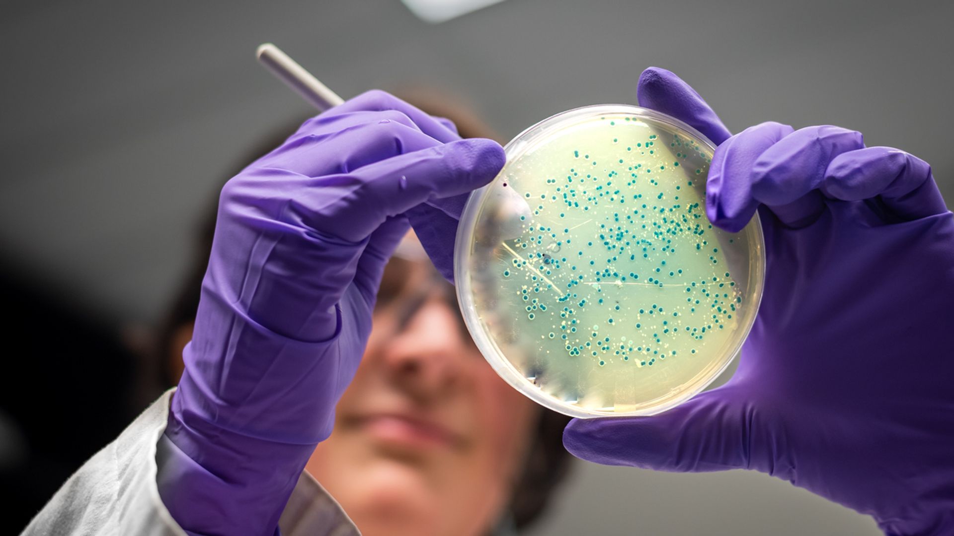 Salmonella salgını erişteyle ilişkilendirildi: 14 ülkeye yayıldı