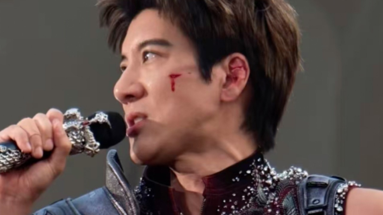 Şarkıcı Leehom Wang sahne kazasında 39 dikiş: Güvenlik endişeleri yeniden gündemde