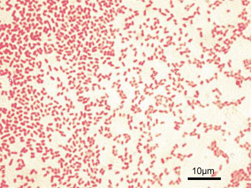 Texas papazı E. Coli'den öldü, hastane test sonucunu yanlış okudu: Dava