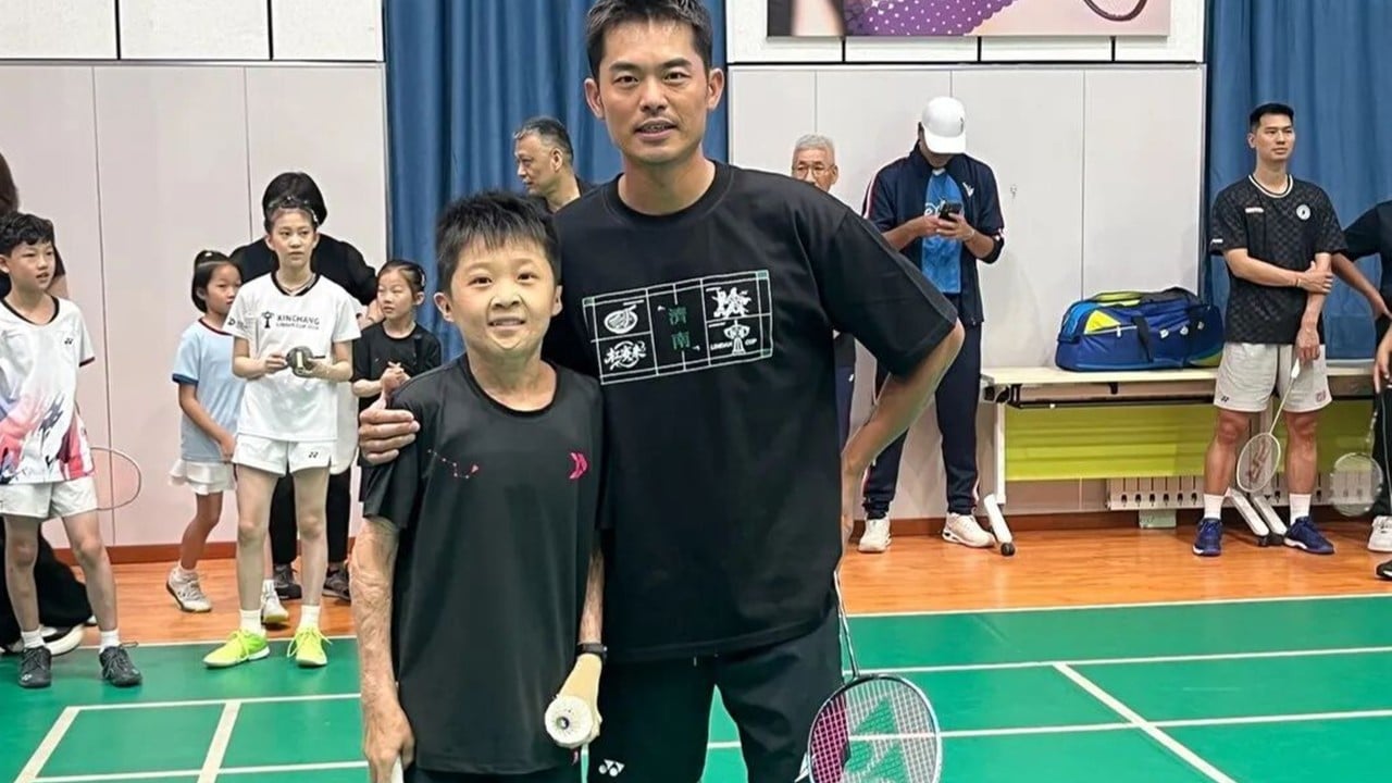 Yanıkların yüzde 97'sini atlatan Çinli çocuk badminton şampiyonu olma hayaliyle antrenman yapıyor