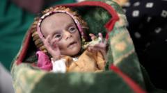 Yemen'de Açlık Krizi: Yeni Doğan İkizler Hayatta Kalma Mücadelesi Veriyor