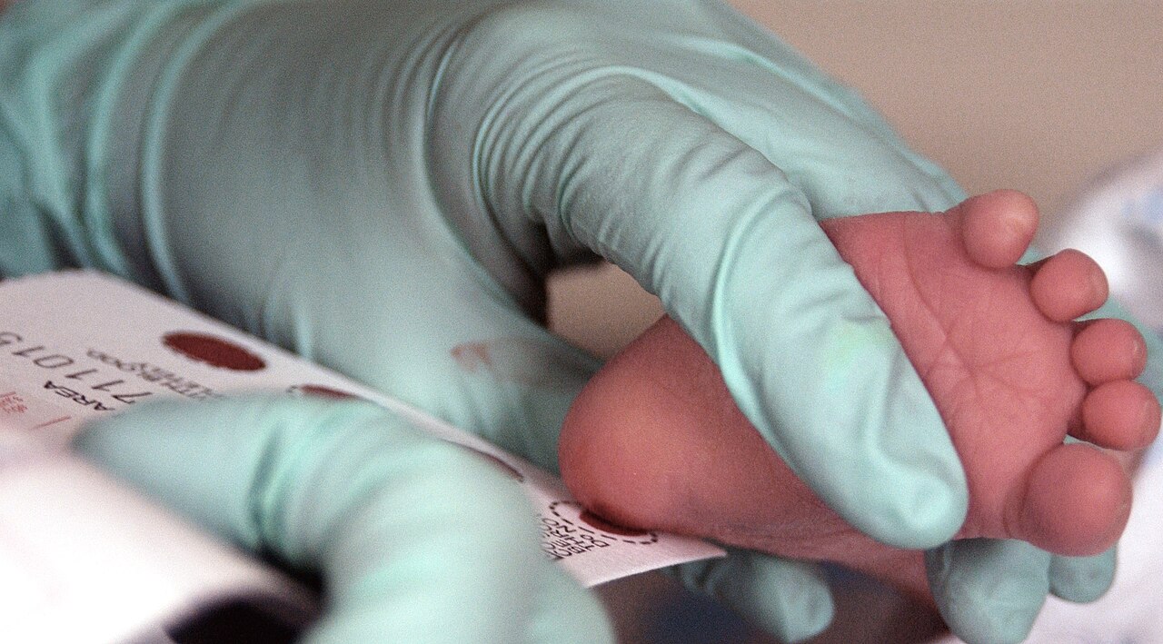 Yenidoğan Jesse'nin Hayatını Değiştiren Test: 7 Gün Sonra Gelen Haber
